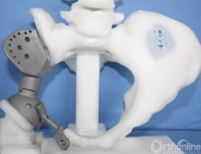 三維打印技術在硬組織外科臨床醫學中的應用現狀與未來展望